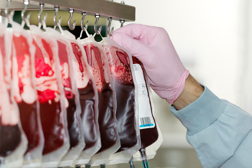 Antes do SUS, o sangue era comercializado no Brasil