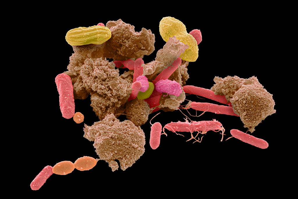 Fezes de 2 mil anos revelam extinção de bactérias da microbiota intestinal humana