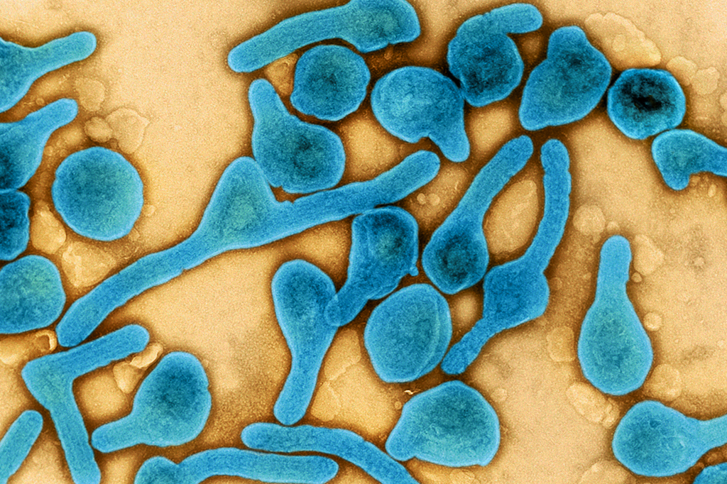 O que se sabe sobre o vírus de Marburg, recentemente detectado na Guiné