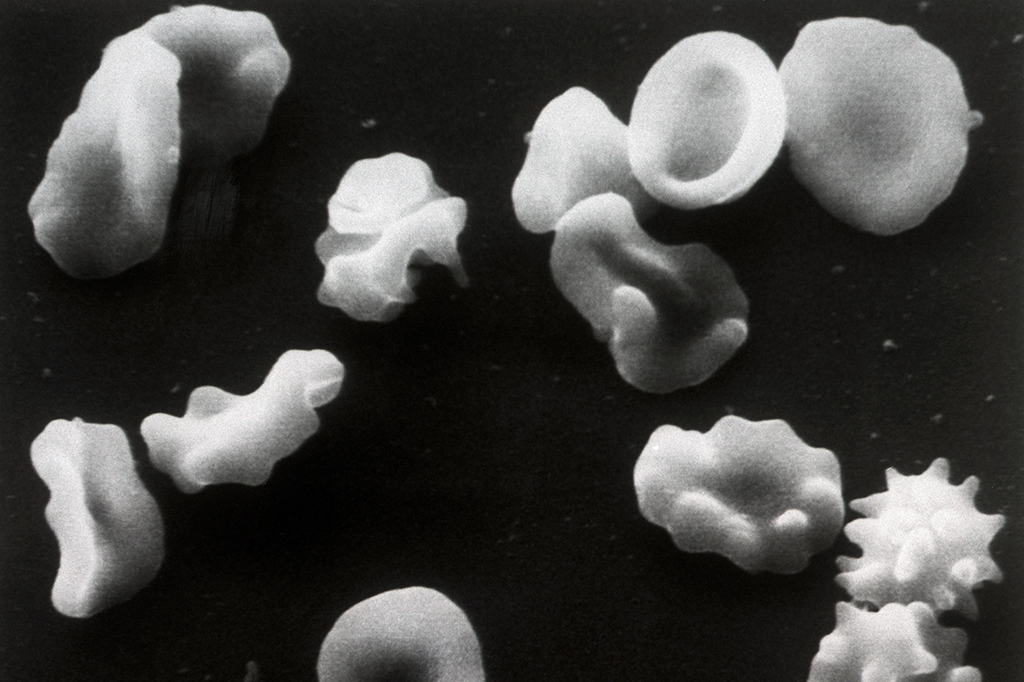 Como a malária mostrou que a seleção natural ainda atua sobre humanos