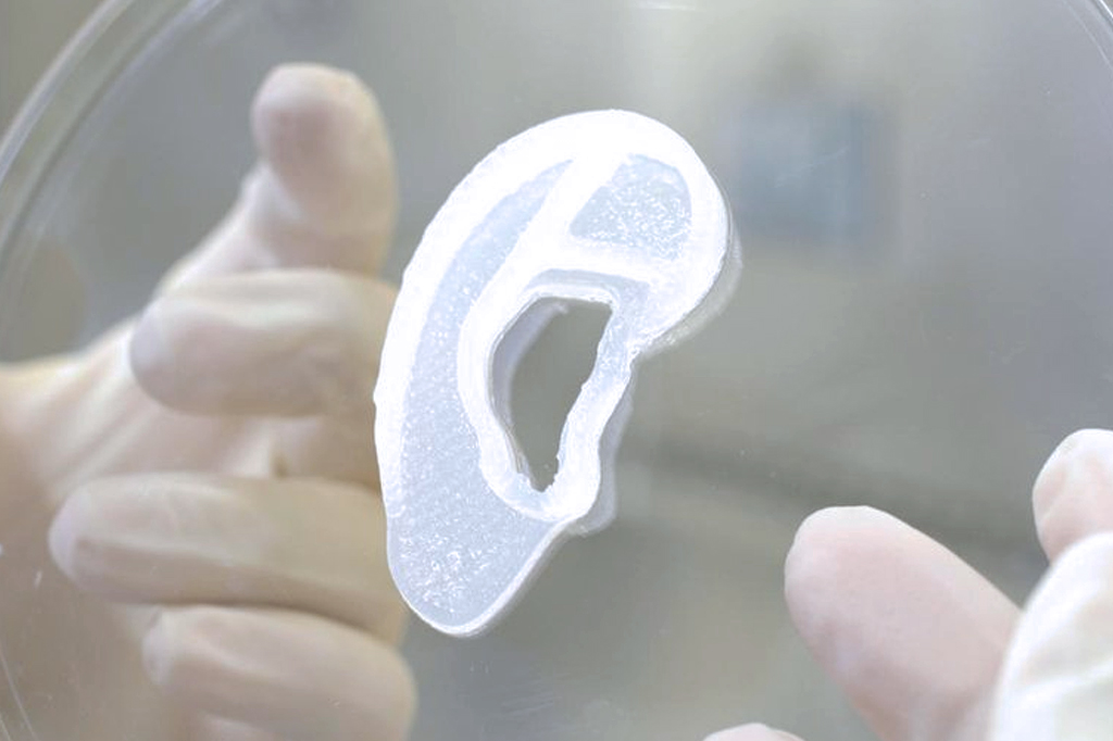 Mulher recebe implante de orelha feita com as próprias células