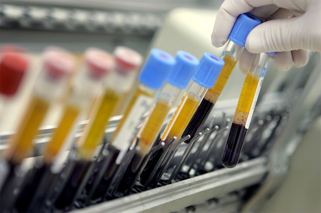 Projeto tenta criar exame que detecta câncer mesmo na ausência de sintomas