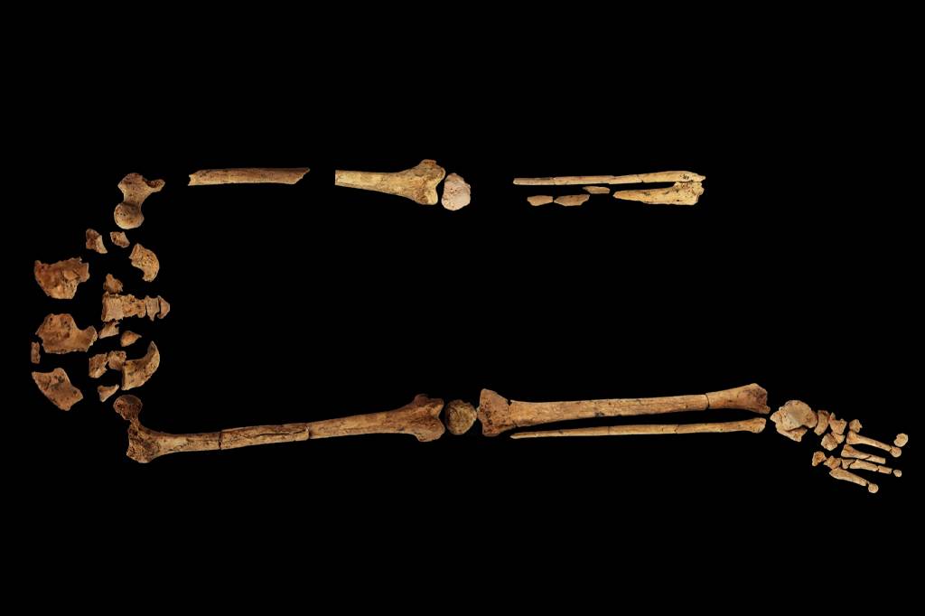 Esqueleto de 31 mil anos é o caso mais antigo de amputação conhecido
