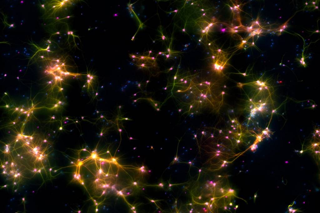 Neurônios aprenderam a jogar videogame em laboratório
