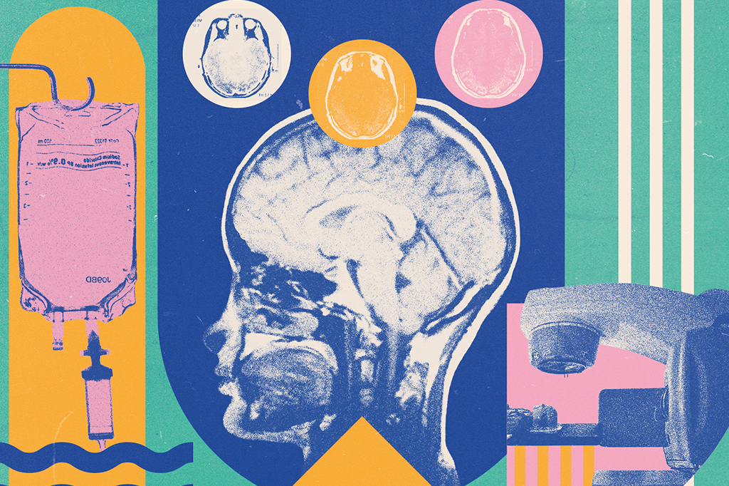 Câncer afeta as conexões entre neurônios