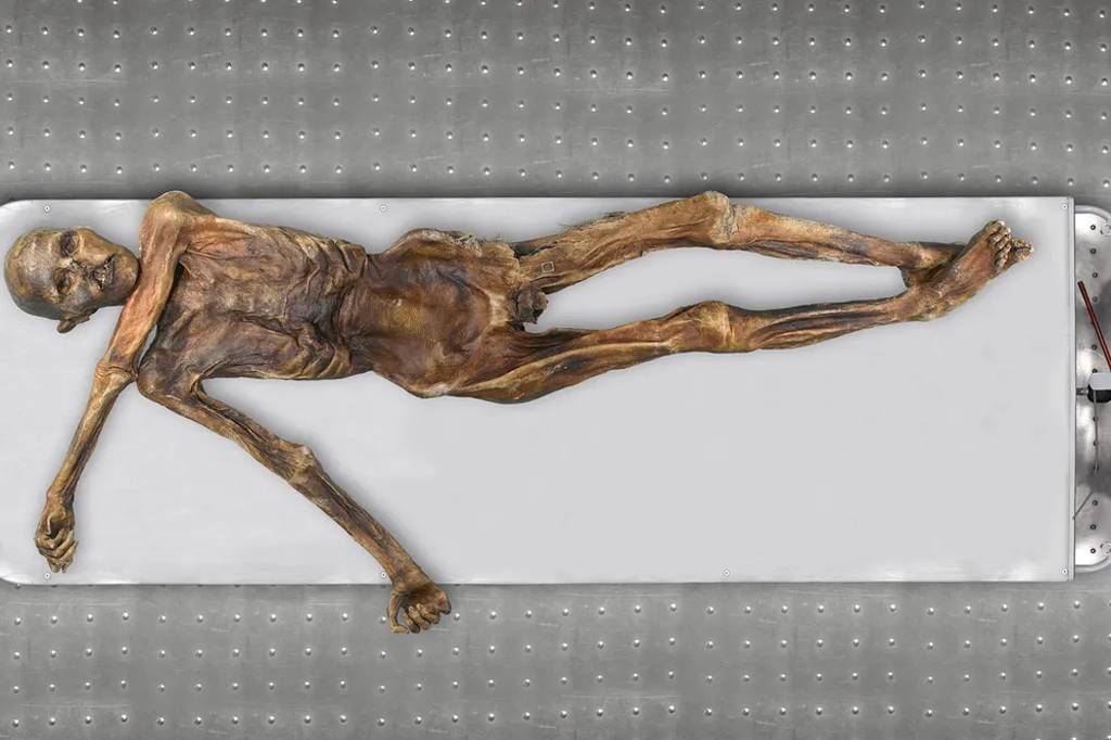 Cientistas descobrem que múmia de 5 mil anos era calva