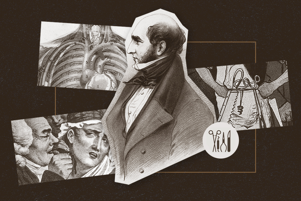 O cirurgião que amputava pernas em 30 segundos