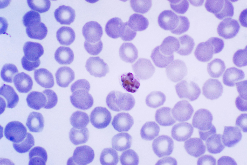 DNA encontrado em esqueleto humano revela caso mais antigo de malária