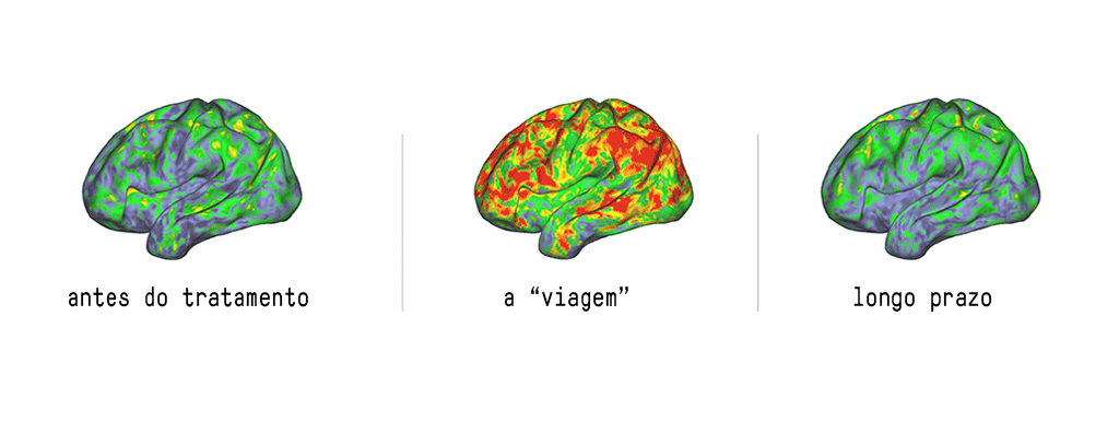 Ilustra&ccedil;&otilde;es diferentes do c&eacute;rebro sob efeito da psilocibina.