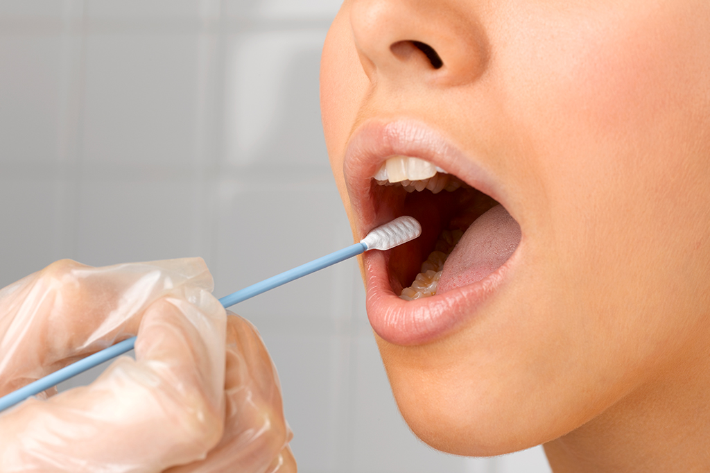 Bactéria da boca pode ajudar a “derreter” alguns tipos de câncer