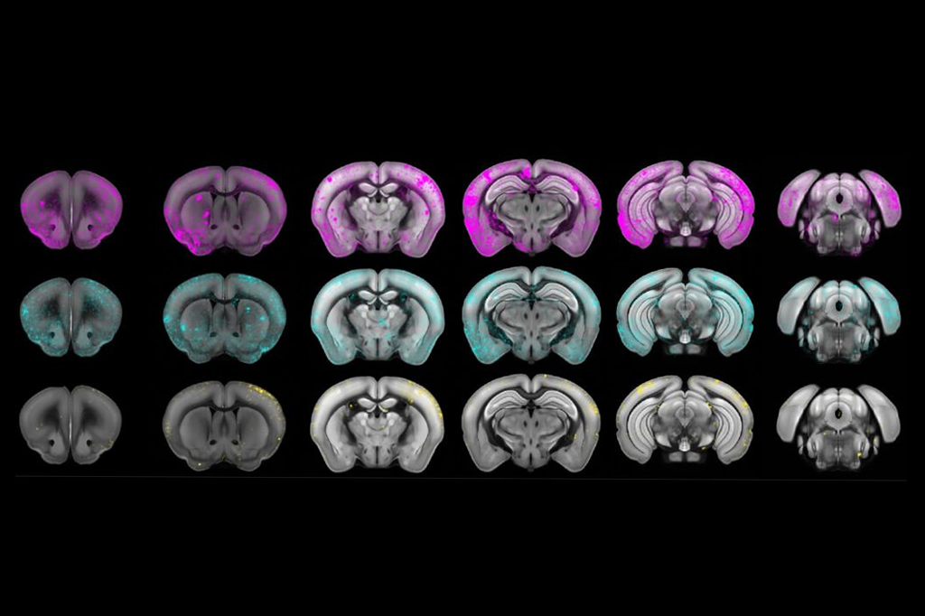 Novo tratamento médico quer “hackear” um parasita que invade cérebros