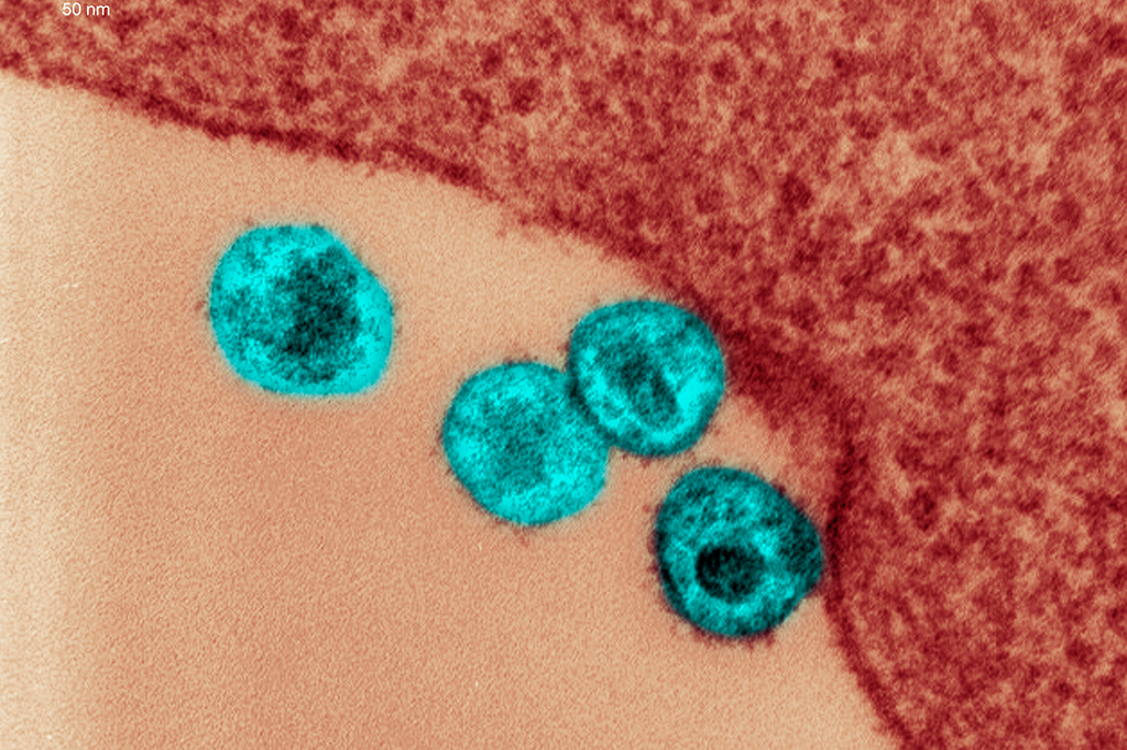 Nova variante do HIV é identificada em três regiões do Brasil