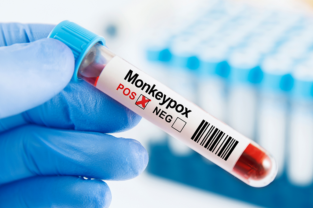 Mpox: África declara emergência pública em todo o continente por causa da doença