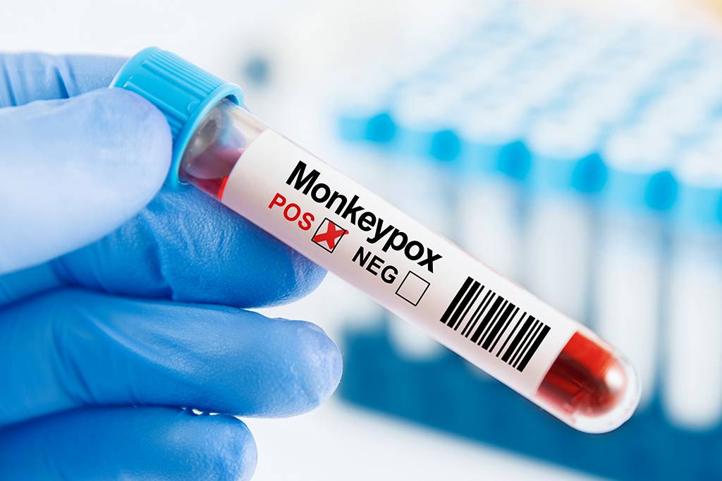 Mpox: África declara emergência pública em todo o continente por causa da doença