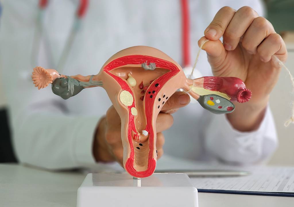 Médico ginecologista liga trompas de Falópio em exemplo de representação do sistema reprodutor feminino.