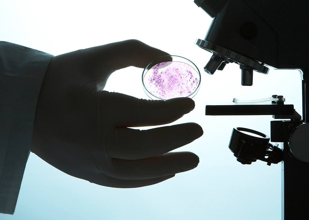 A colônia de bactérias comedoras de nylon que surgiu no Japão em 1975