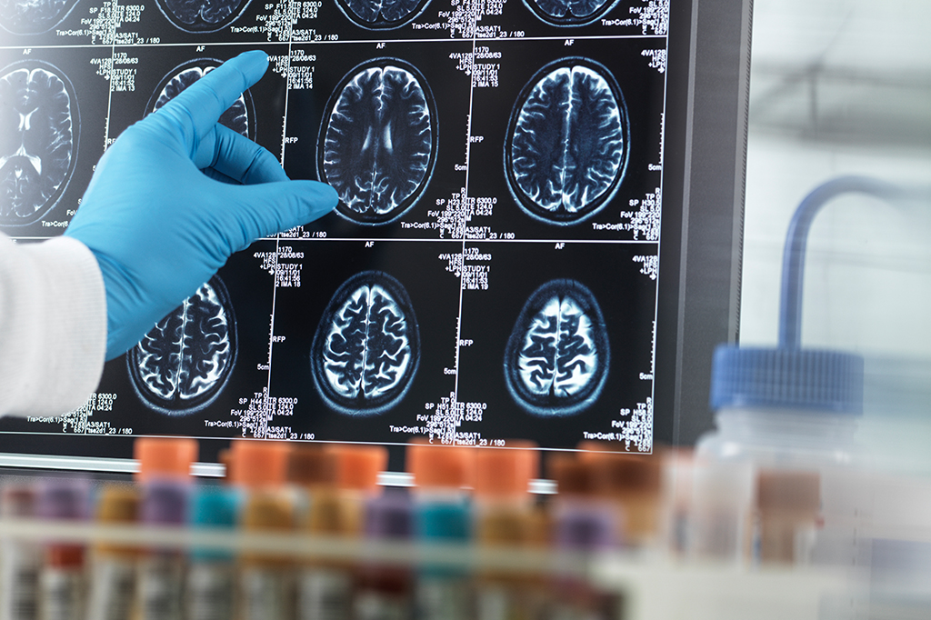 Ressonância magnética cerebral mostra que meditação mindfulness para a dor não é placebo