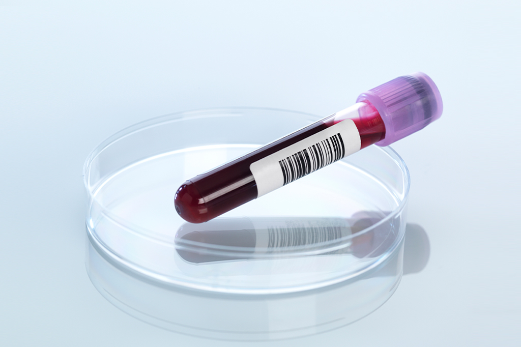 O que se sabe sobre a “doença misteriosa” que já matou 143 pessoas no Congo