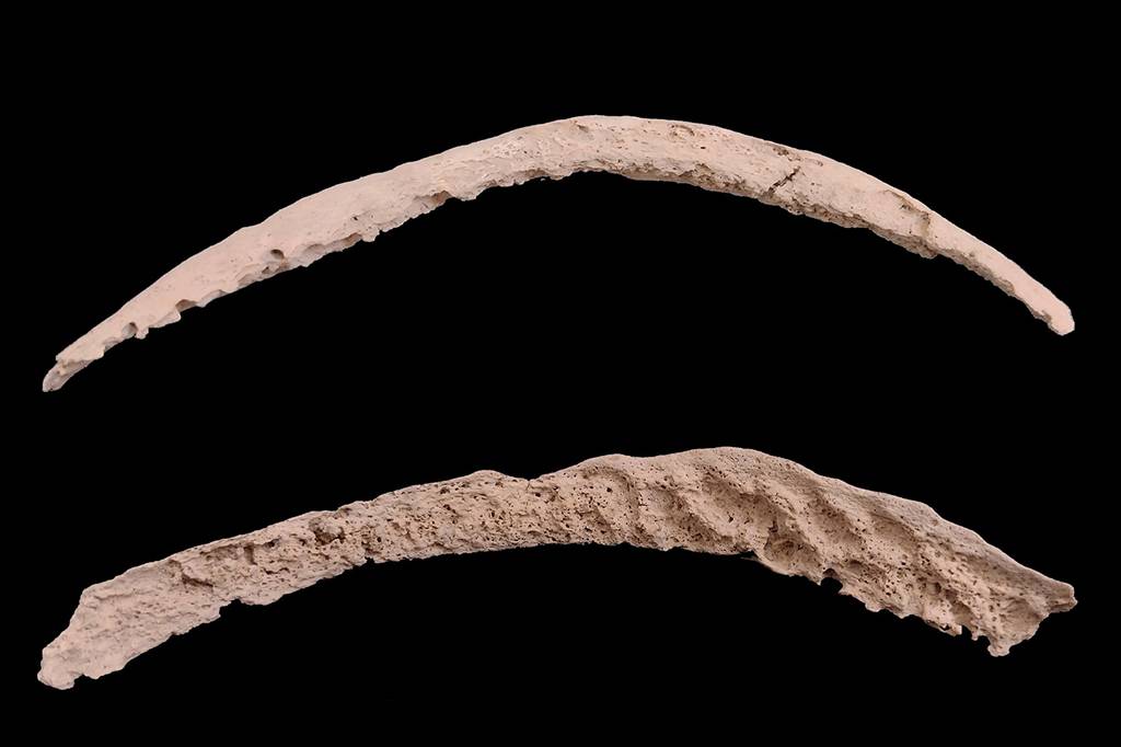 Ossos de 9 mil anos podem explicar origem da sífilis