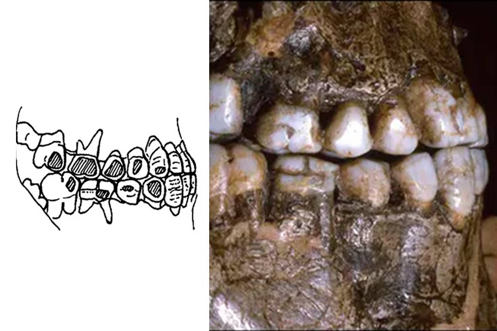 Há 30 mil anos, piercing na bochecha era a moda entre os europeus da era do gelo