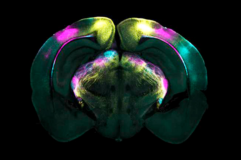 1202-medo-layout_site1 Imagem do Corte coronal do cérebro mostrando projeções de diferentes áreas visuais no córtex cerebral para o núcleo geniculado ventrolateral (vLGN).
