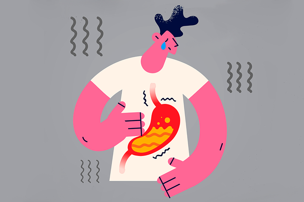 Ilustração de uma pessoa com dor no estômago por causa de uma intoxicação alimentar.