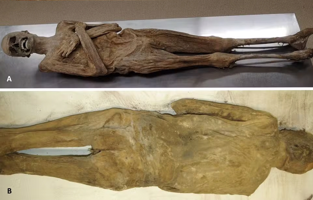 Fotografia do aspecto externo da m&uacute;mia, visto do lado ventral (A) e dorsal (B), mostrando a parede corporal completamente intacta.