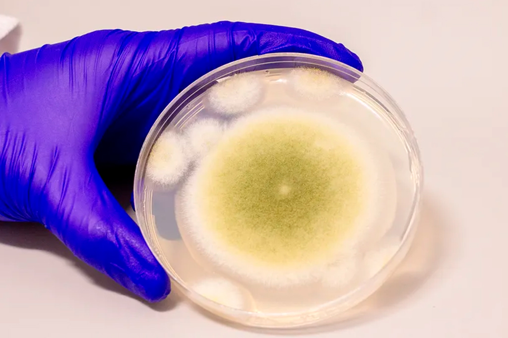 Fotografia da amostra de Aspergillus flavus, o fungo considerado responsável pela "maldição da múmia".