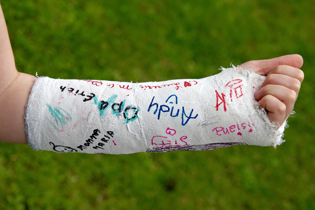 Quando começaram a usar gesso na ortopedia?