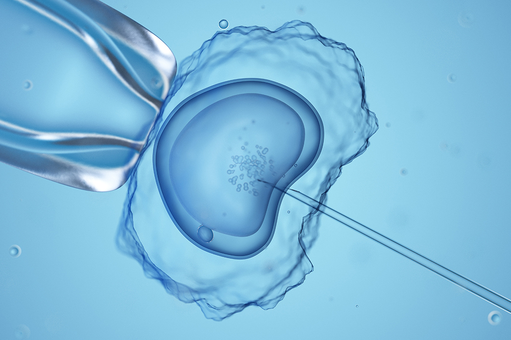Bebês com DNA de 3 pessoas nascem livres de doenças hereditárias; entenda técnica