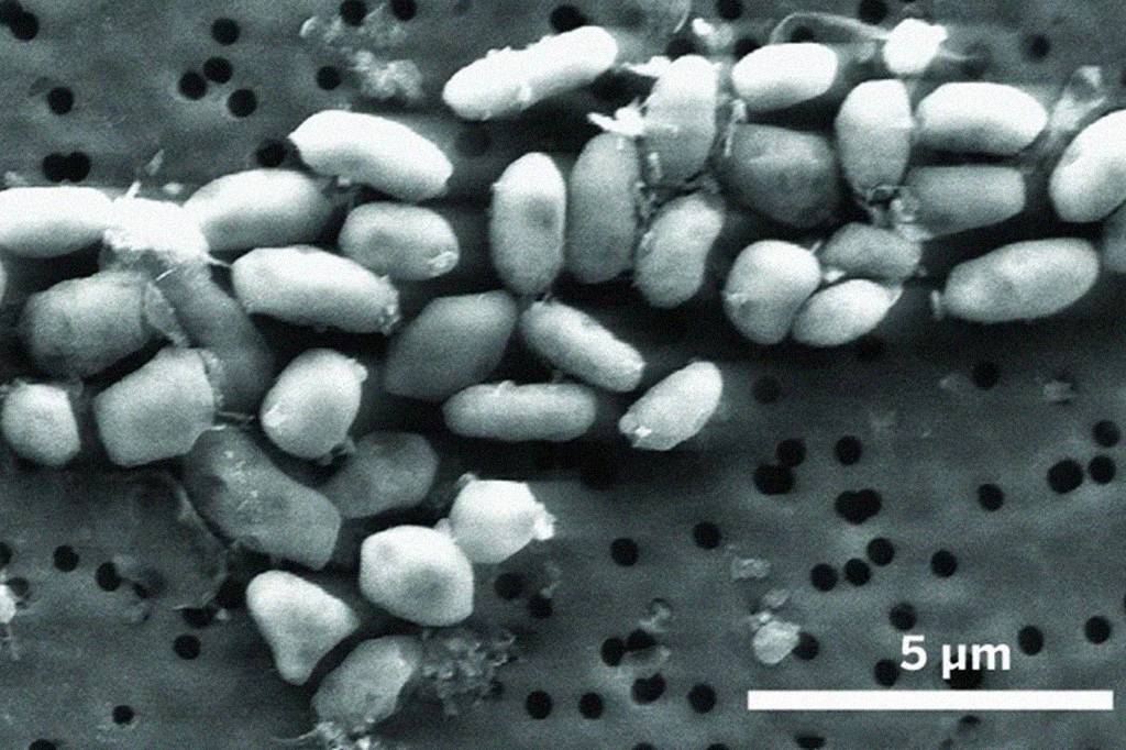 Estudo da Nasa sobre bactéria que vive de arsênio é “despublicado” após 15 anos