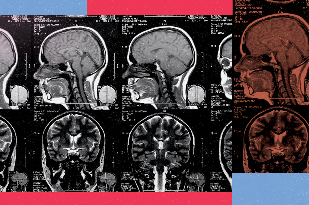 Cientistas conseguem medir o “qualia” no cérebro