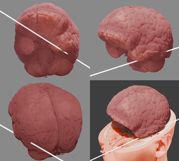 Reconstru&ccedil;&atilde;o digital do c&eacute;rebro do f&iacute;sico Anatoli Bugorski.