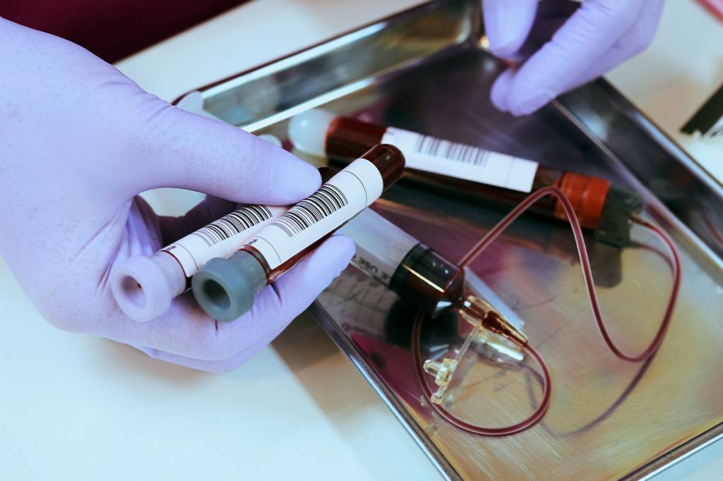 Imunoterapia pode ser caminho promissor para a cura do HIV, aponta estudo
