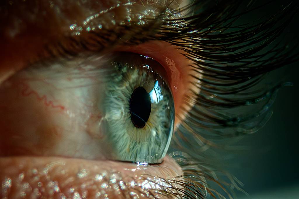 “Trend” nas redes sociais, raspar os cílios pode causar lesões nos olhos