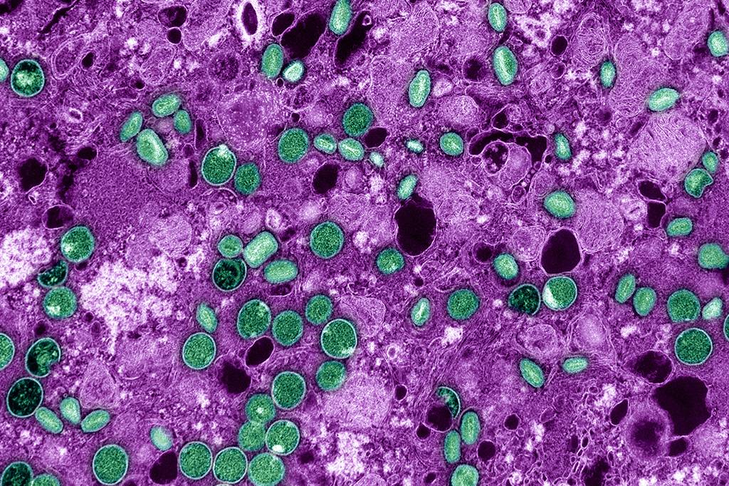 Dossiê mpox: 16 perguntas e respostas para entender a doença