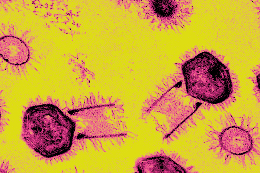 Imagem microsc&oacute;pica do v&iacute;rus Tupanvirus.