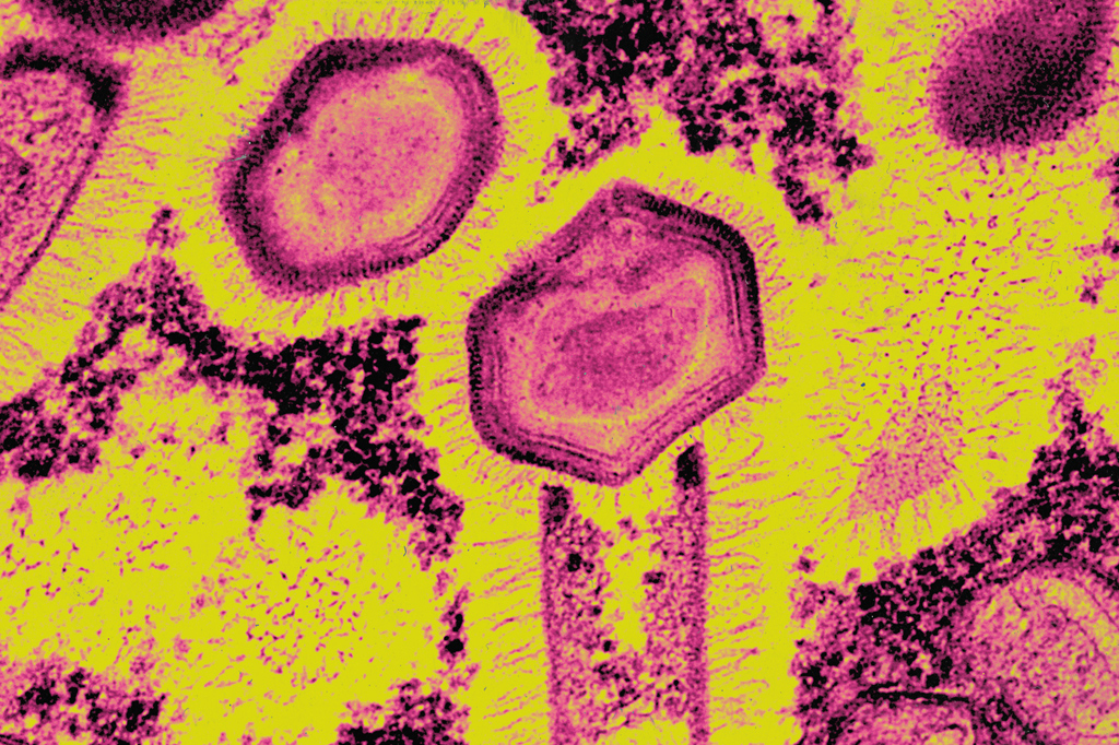 Imagem microsc&oacute;pica do v&iacute;rus Tupanvirus.