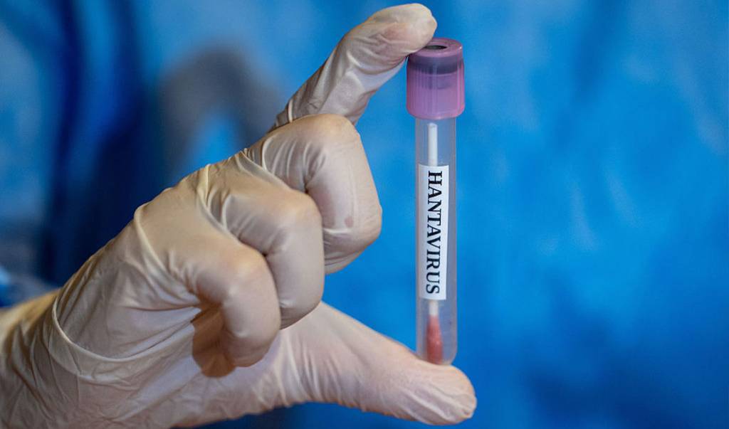 Quantos casos de hantavirose o Brasil registra por ano?