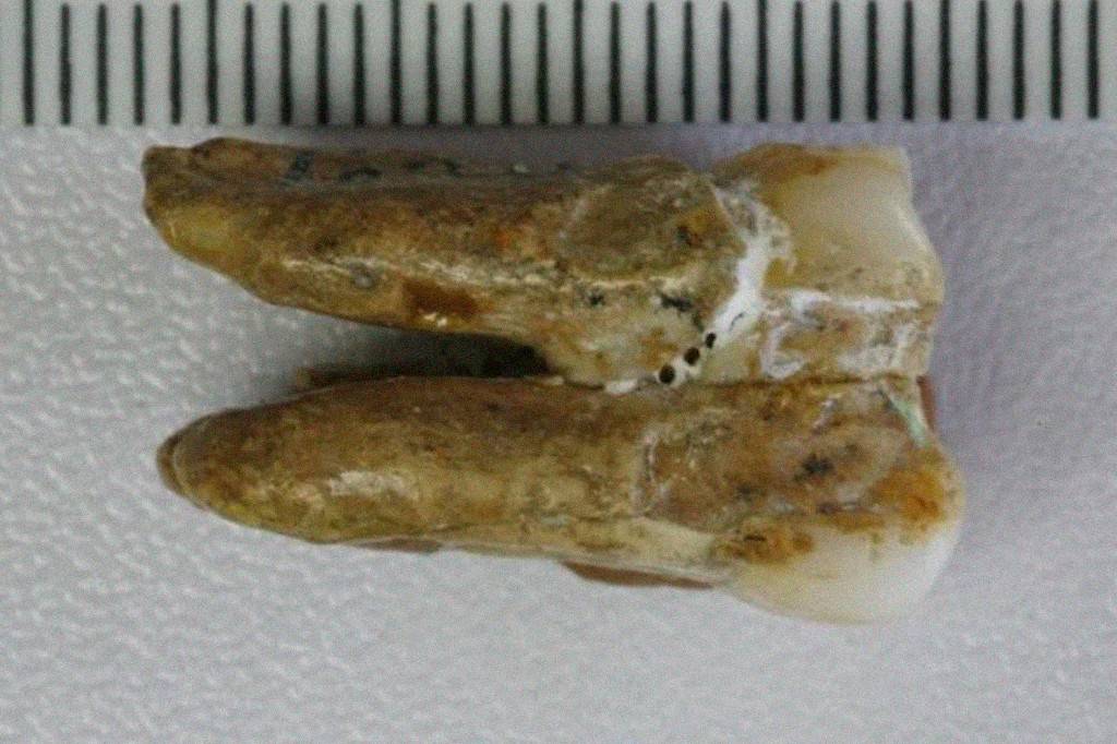 Dentes de 400 mil anos apontam cruzamento entre denisovanos e Homo erectus
