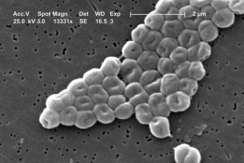 Acinetobacter: a superbactéria encontrada em Porto Alegre é uma das mais perigosas do mundo?